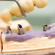 Illustration for article titled Some Important Methods To Assess Your Professional Dentist